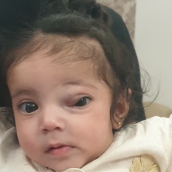 Paediatric